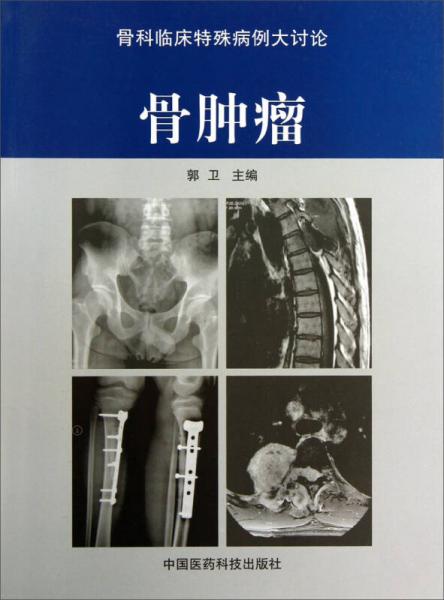 《骨肿瘤》郭卫主编 北京：中国医药科技出版社 2013