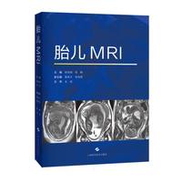 胎儿MRI