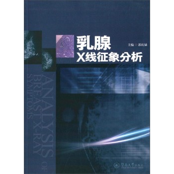 乳腺X线征象分析