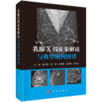 乳腺X线征象解读与典型病例图谱