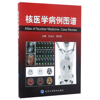 核医学病例图谱