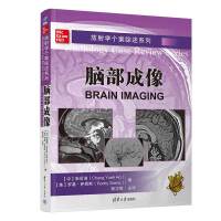 放射学个案综述系列：脑部成像