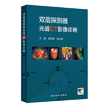  双层探测器光谱CT影像诊断