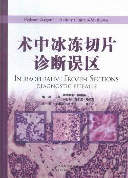 术中冰冻切片诊断误区